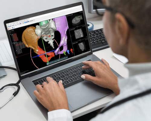 Software de planificación preoperatoria - OOOPDS - Taiwan Main Orthopaedic Biotechnology - médico / para imágenes médicas / de planificación para radiocirugía
