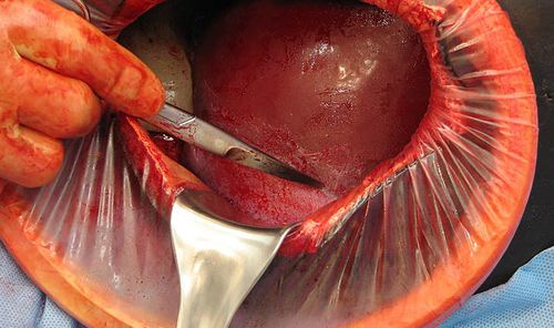 Simulador de paciente de parto - C-Celia C-SECTION - Operative Experience Inc. - para cuidados de urgencias / de cirugía / obstetricoginecológico