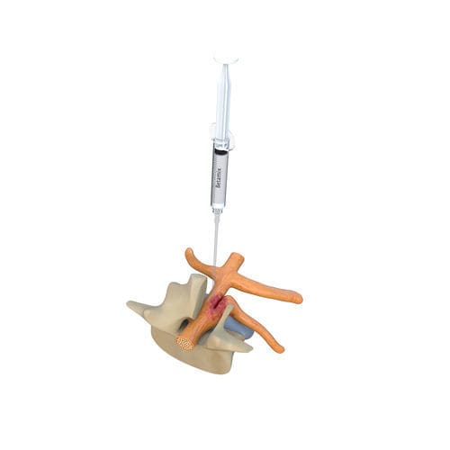 Barrera antiadherencia gel - BETAMIX - Betatech Medical - laparotomía abdominal / laparotomía pélvica / cesárea