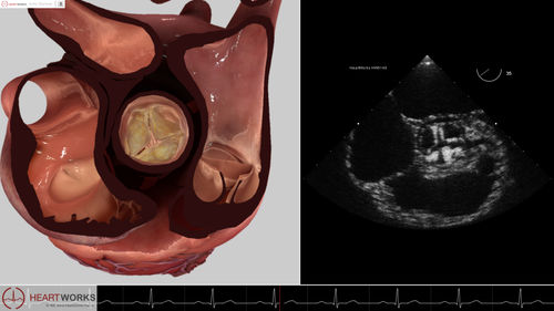 Módulo de software para ecocardiografía - Pathology Module 2 - Inventive Medical Limited - de evaluación