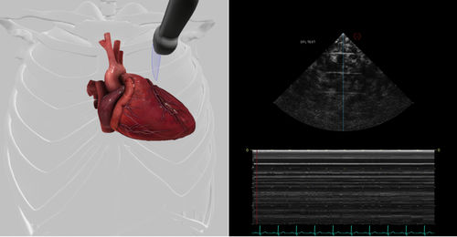 Módulo de software para ecocardiografía - Pathology Module 7 - Inventive Medical Limited - de evaluación