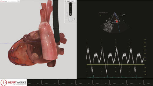 Módulo de software para ecocardiografía - Pathology Module 3 - Inventive Medical Limited - de evaluación
