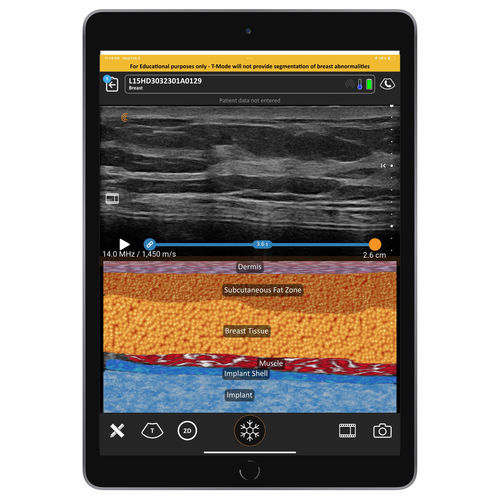 Software para ecografía - T-Mode  - Clarius Mobile Health - de visualización / médico