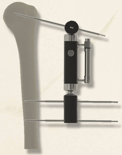 Fijador externo para húmero - 40140030101 - Biotech Medical - tubular / para adulto