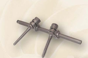 Sistema de osteosíntesis toraco-lumbo-sacro - DLC - Biotech Medical - vía posterior / para adulto