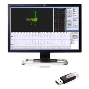 Software para ECG - iTengo+  - BORSAM Biomedical Instrument - de hospital / para informes / de análisis