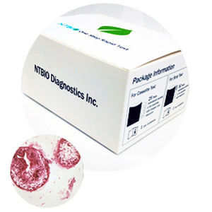 Prueba rápida de FOB - N040 series - NTBIO Diagnostics - para el cáncer / de oncología / de marcadores tumorales
