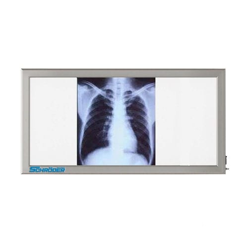 Negatoscopio 3 pantallas - NT 130 - SCHRODER HEALTH PROJECTS - de luz blanca