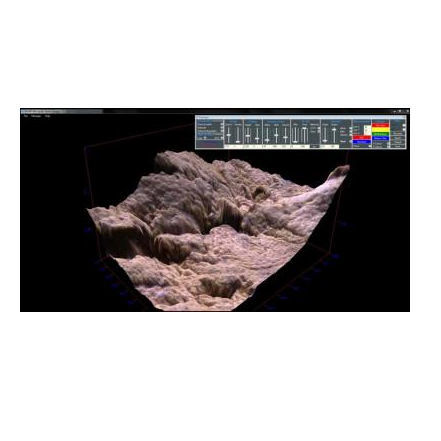 Software médico - MiVim - Microptik BV - de análisis de imágenes / de medición / de fusión