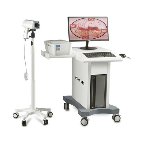 Colposcopio vídeo - KN-2200 - Kernel Medical Equipment Co., Ltd - en carro