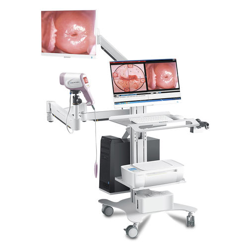 Colposcopio vídeo - KN-2200I HD  - Kernel Medical Equipment Co., Ltd - en carro