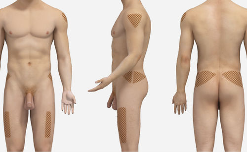 Módulo de simulación de inyección intramuscular - SIMTICS - para atención general / procesos basados en la web