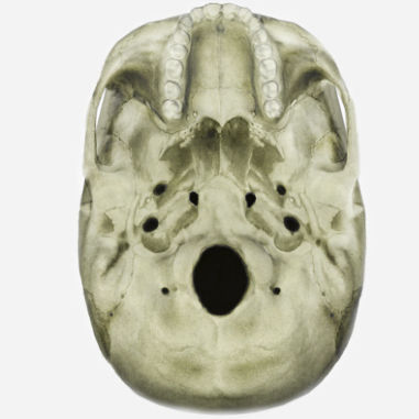 Módulo de simulación para radiología - SIMTICS - de anatomía / con aneurisma intracraneal / procesos basados en la web