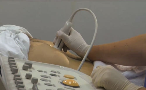 Módulo de simulación para ecografía - SIMTICS - para colangiopancreatografía retrógrada endoscópica / de anatomía / procesos basados en la web