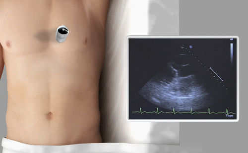 Módulo de simulación para ecocardiografía - SIMTICS - de anatomía / procesos basados en la web