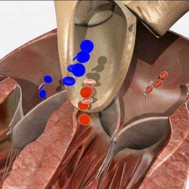 Módulo de simulación para ecocardiografía - SIMTICS - de anatomía / para valvuloplastia / procesos basados en la web