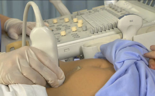 Módulo de simulación para ecografía - SIMTICS - de anatomía / femenino / procesos basados en la web
