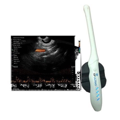 Ecógrafo portátil - SIFULTRAS-6.36 - SIFSOF - para ecografía endovaginal / doppler-color / blanco y negro