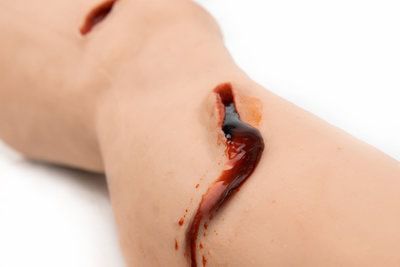 Maniquí de prácticas para atención general - MEDICAL-X - con trauma / de pierna / de plástico