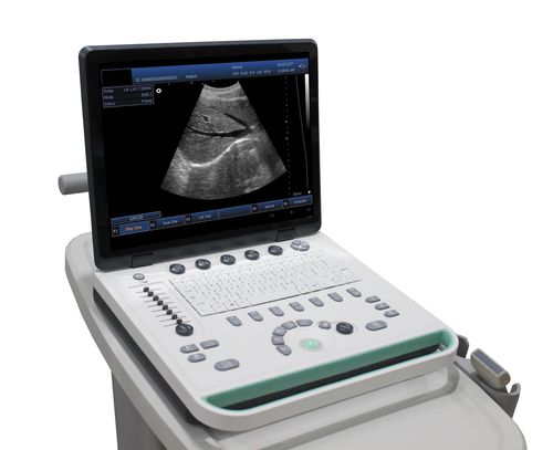 Ecógrafo portátil, con carro - DP-50  - Promed Technology - para ecografía ginecológica y obstétrica / para ecografías abdominales y pélvicas / para ecografía urológica