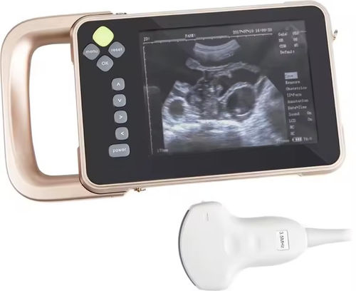 Ecógrafo veterinario de mano - V5 - Promed Technology - multifuncional / para animales pequeños / para animales grandes