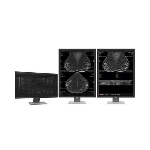 Software médico - MammoScape™ - VAREX Imaging - TDM / de radiografía / para mamografía
