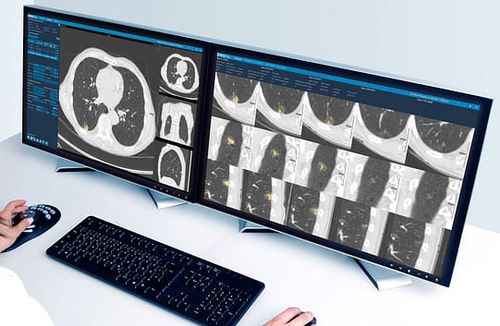 Software médico - Veolity - VAREX Imaging - de radiografía / de análisis de imágenes / de gestión