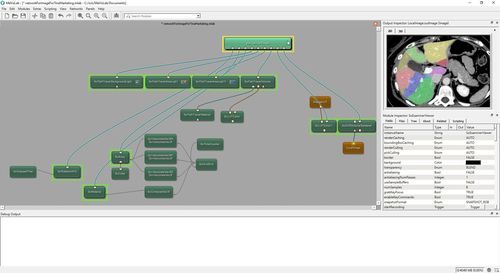 Software de análisis - MeVisLab - VAREX Imaging - de tratamiento de datos / médico / de radiología