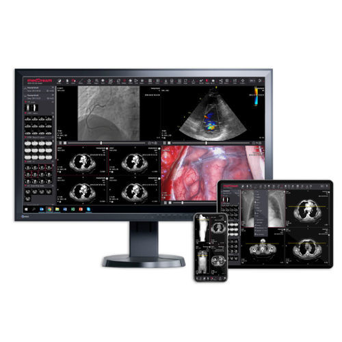Aplicación web de visualización - MEDDREAM - visualizador / de diseño / médica