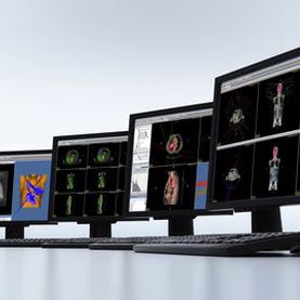Software de visualización - DICOM RT Studio - PTW Freiburg Physikalisch-Technische-Werkstätten - de tratamiento / para radioterapia