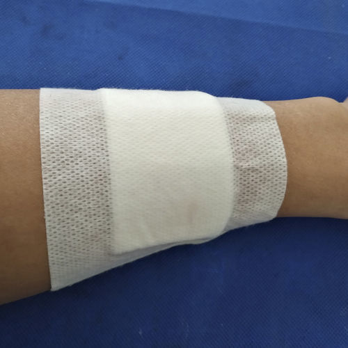 Compresa de gasa antimicrobiana - Hongkong Medi - biorreabsorbible / hemostático
