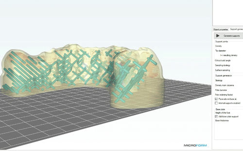 Software para odontología -  MicroForm® - Microlay - de visualización 3D / de importación / de impresión 3D