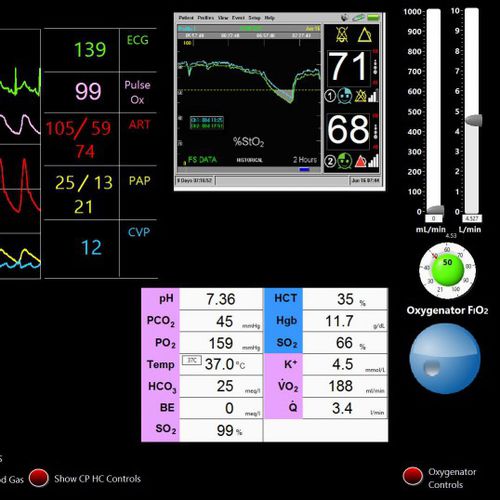 Simulador para cuidados cardiopulmonares - Biomed Simulation Inc. - para cirugía cardíaca / pantalla / asistido por ordenador