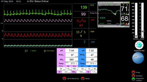 Simulador de paciente para ECMO - Biomed Simulation Inc. - para cuidados cardiopulmonares / pantalla / asistido por ordenador