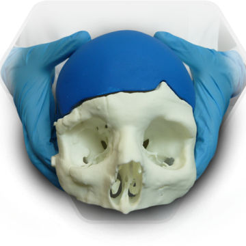 Implante craneal a medida - SkullPT  - 3D Side