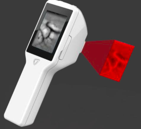 Detector de venas de infrarrojos - Veinus Pro - InfraEyes - para punción venosa / de mano
