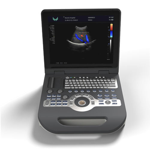 Ecógrafo portátil - XF3500 - Xianfeng Ultrasound Medical - para ecografía polivalente / blanco y negro / doppler-color