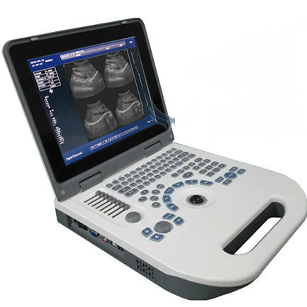 Ecógrafo portátil - XF30A(XF50)  - Xianfeng Ultrasound Medical - para ecografía polivalente / blanco y negro / convexo