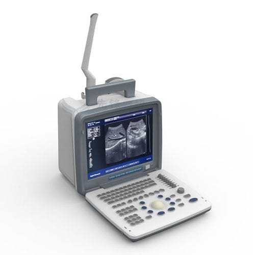 Ecógrafo portátil - XF300 - Xianfeng Ultrasound Medical - para ecografía polivalente / blanco y negro / consola integrada
