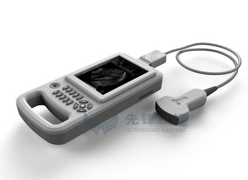 Ecógrafo de mano - XF20 - Xianfeng Ultrasound Medical - para ecografía polivalente / blanco y negro