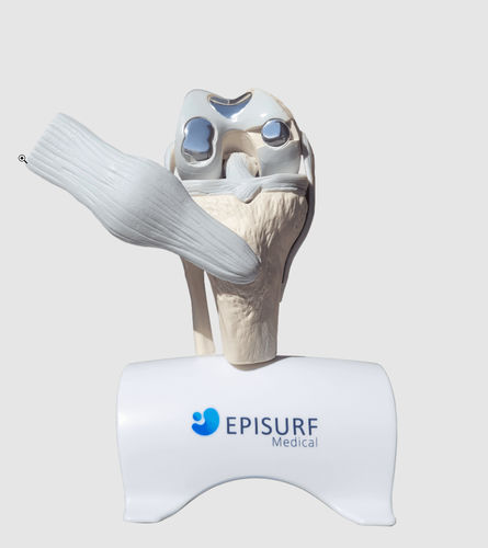 Implante de rodilla - Episurf Medical - anatómico / de cromo-cobalto