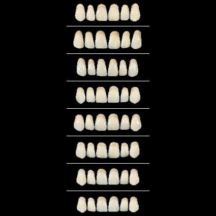 Prótesis dental de fibra acrílica - Almamiss Upper  - Wiedent - de los dientes anteriores