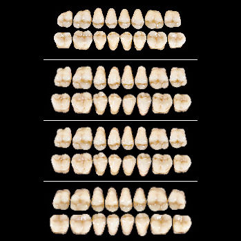 Prótesis dental de fibra acrílica - Almamiss   - Wiedent - para dientes posteriores