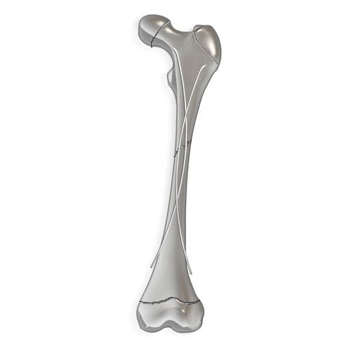 Clavo intramedular para fémur - pediFlex™ - OrthoPediatrics - para tibia / para peroné / para húmero