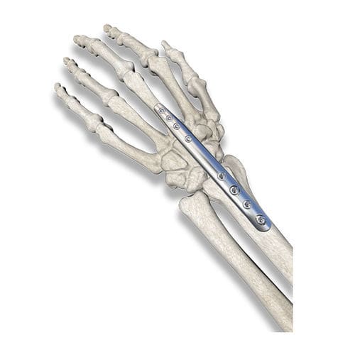 Placa de artrodesis para muñeca - PediFrag  - OrthoPediatrics - metálica / pediátrica