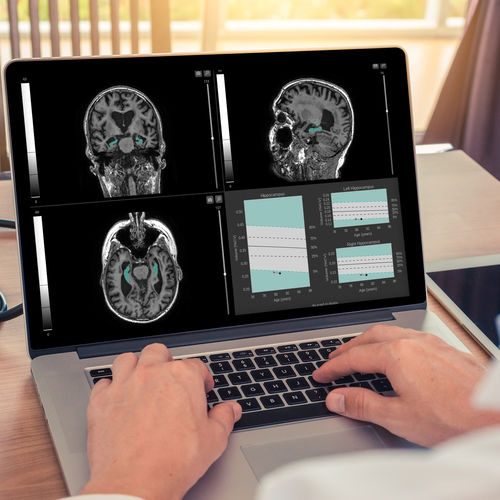 Software de análisis de imágenes - QyScore® - qynapse - para informes / de visualización / de diagnóstico