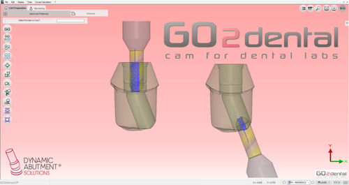 Software de laboratorio dental - GO2dental - Dynamic Abutment Solutions - FAO
