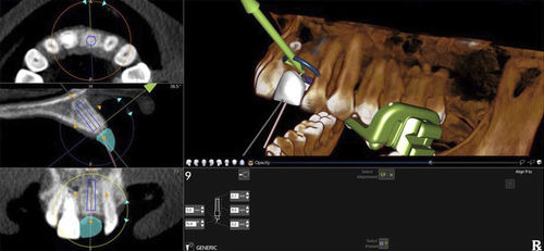 Software de planificación - X-Guide - X-Nav Technologies - de importación / de navegación / de anatomía