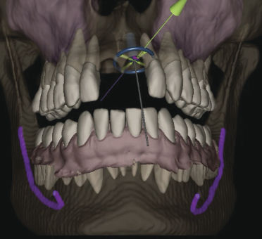 Software de anatomía - IconiX  - X-Nav Technologies - para odontología / para cirugía / de planificación