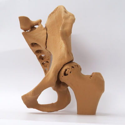 Modelo anatómico de hueso - 3D Lifeprints UK Ltd - de pelvis / de cadera / de formación